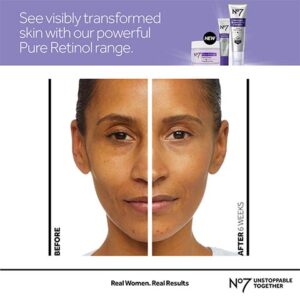 Tretinoin cream for under-eye treatment.