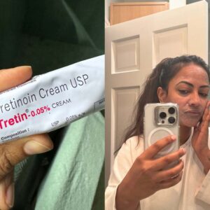 Tretinoin 0.01% gel before & after results.