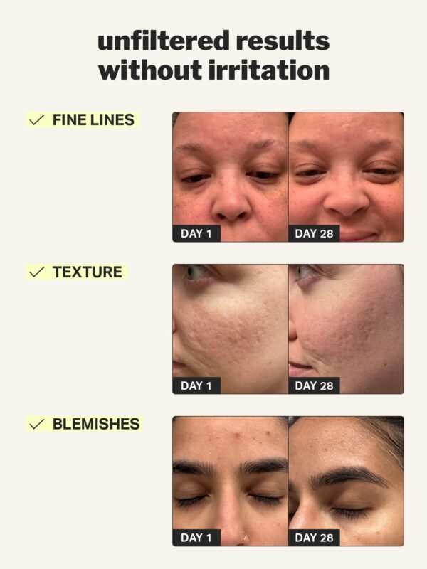 Retinol 0.01% Gel, skincare product