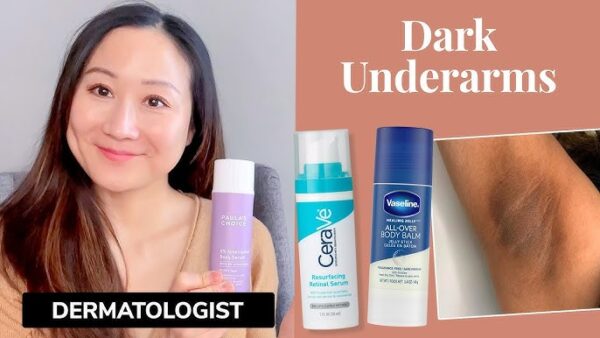 Tretinoin cream for underarm use.