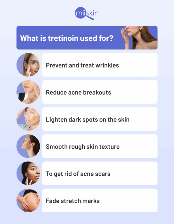Tretinoin cream for old scar treatment.